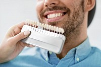 Fogszín meghatározás