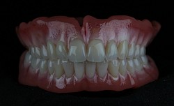 BioFIX Individual 3D