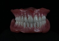 Alap fogsor karakterizált műíny kialakítással